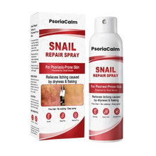 PsoriaCalm